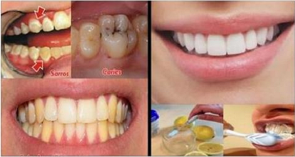 Teeth Remedy