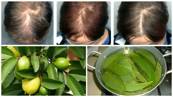 header-regrow-hair-stop-hair-loss-with-guava-leaves