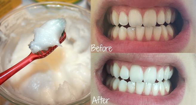 New-Study-Reveals-Coconut-Oil-Is-Far-Better-Than-Your-Toothpaste