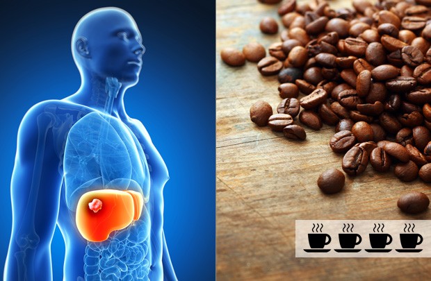 coffee-cancer-liver_0