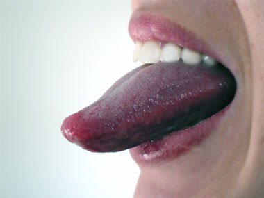03-white-teeth-clean-tongue-sl